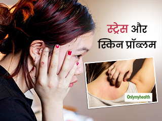 Skin Problems In Hindi त वच क समस य ए और उसन बचन क उप य