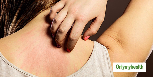 Stress and Skin Problems