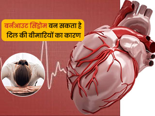 बर्नआउट सिंड्रोम बन सकता है दिल की बीमारियों का कारण, अध्‍ययन में हुआ खुलासा 
