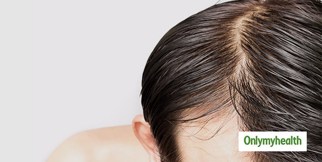 scalp-inflammation-home-remedies-these-5-signs-of-scalp-inflammation