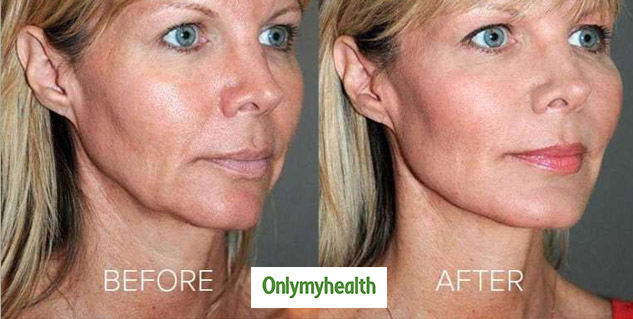 Skin Treatment