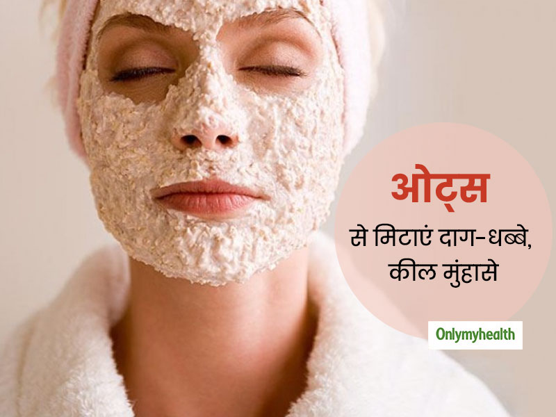 क्या आप भी हैं कील, मुंहासों और चेहरे के दाग-धब्बों से परेशान? 2 तरह से ओट्स का प्रयोग करें, दूर होगी समस्या