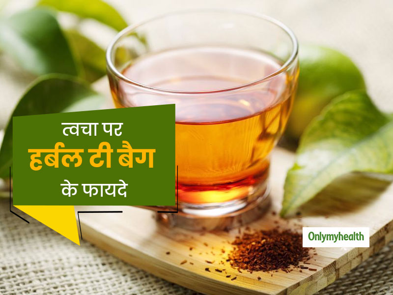 चेहरे से दाग-धब्बों को दूर करने के लिए मददगार है हर्बल टी बैग, जानें इसको लगाने का तरीका