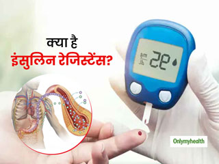 टाइप 2 डायबिटीज का प्रमुख कारण है बॉडी का इंसुलिन रेजिस्टेंस हो जाना, जानें कारण और बचाव के तरीके