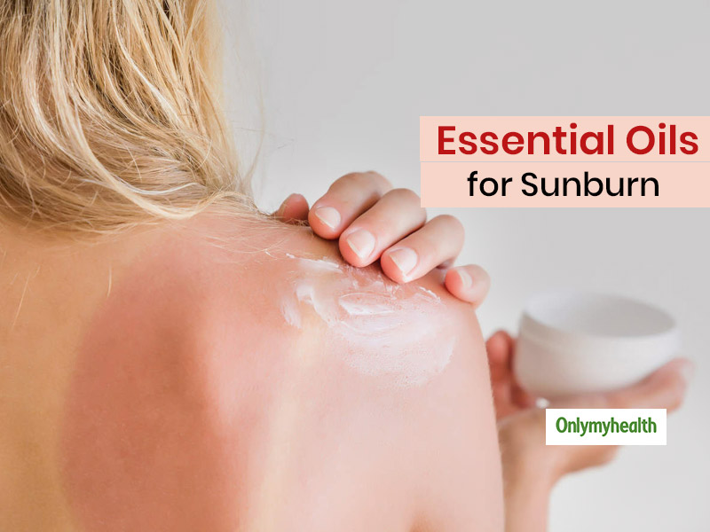 Blog - Natural Remedies for Sunburn - Health Simplified