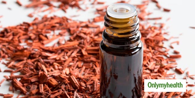Sandalwood Oil For Sunburn