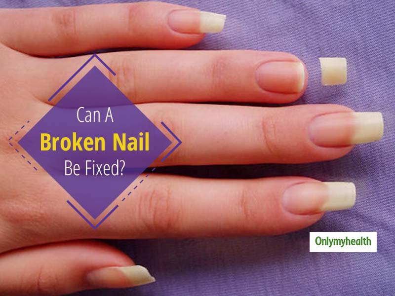 Can A Broken Nail Be Fixed? Try This Easy 8Step Process To Glue A