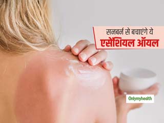 Essential Oils For Sunburn : सनबर्न या टैनिंग से राहत दिलाएंगे ये 4 एसेंशियल ऑयल, तुरंत मिलेगा फायदा  