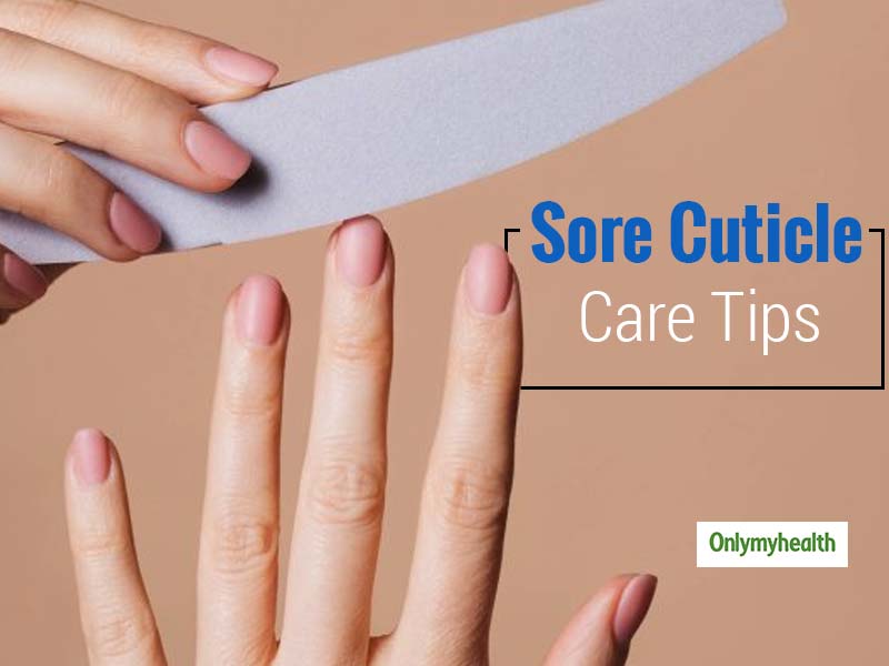 Nail Care Tips: Home Remedies For Sore Cuticles