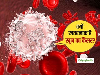 खून का कैंसर (ल्यूकीमिया) क्यों बढ़ता है तेजी से? वैज्ञानिकों ने खोज ली है वजह, आसान हो जाएगा इलाज