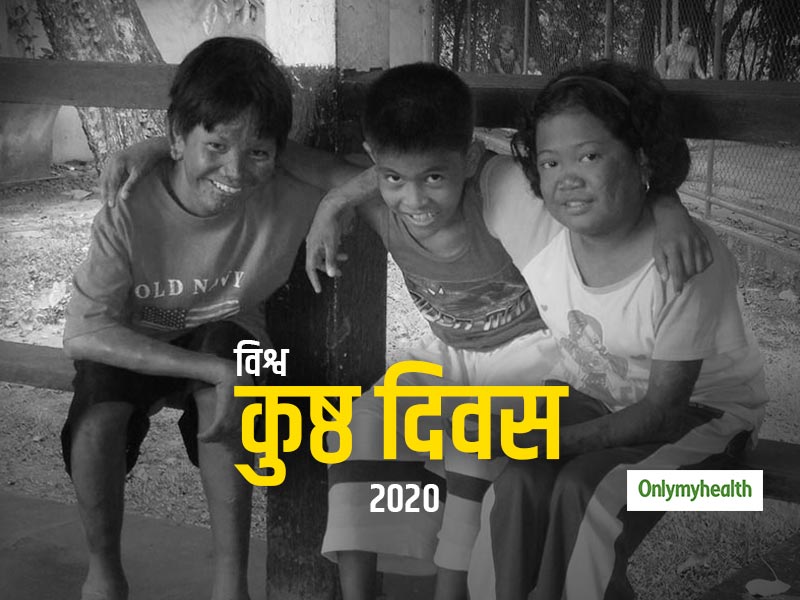 World Leprosy Day 2020: कुष्ठ रोग से जुड़े इन आम भ्रम पर न करें भरोसा, जान लें इनके पीछे के तथ्य