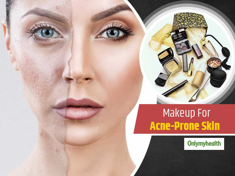 Makeup Essentials For People With Acne-Prone Skin