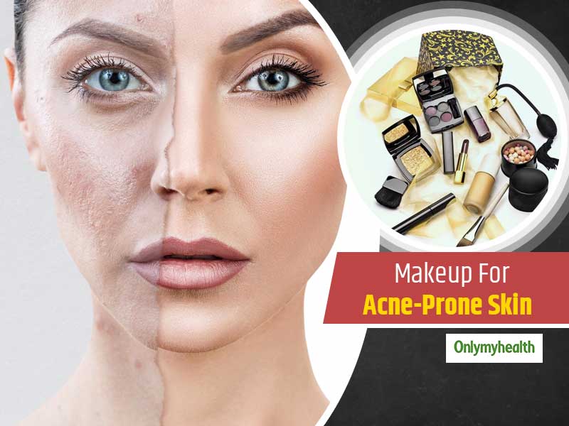 Makeup Essentials For People With Acne-Prone Skin - Makeup Essentials