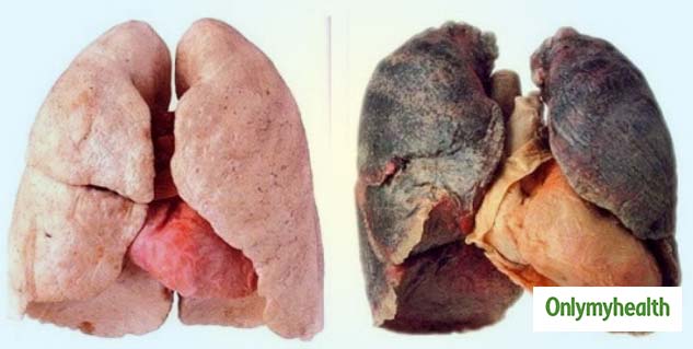 detox-lungs