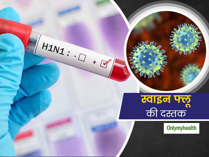 Swine Flu Knocks Again In 2020, First Confirmed Case In Greater Noida