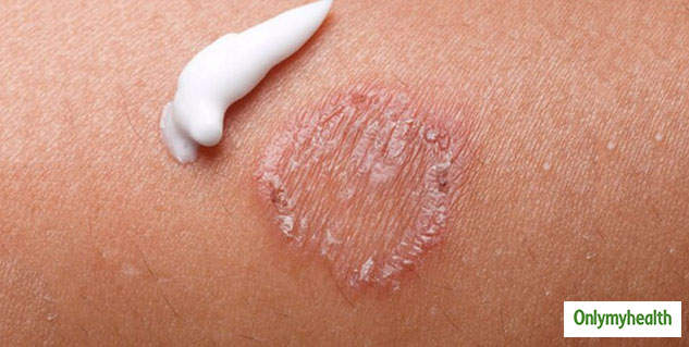skinproblems