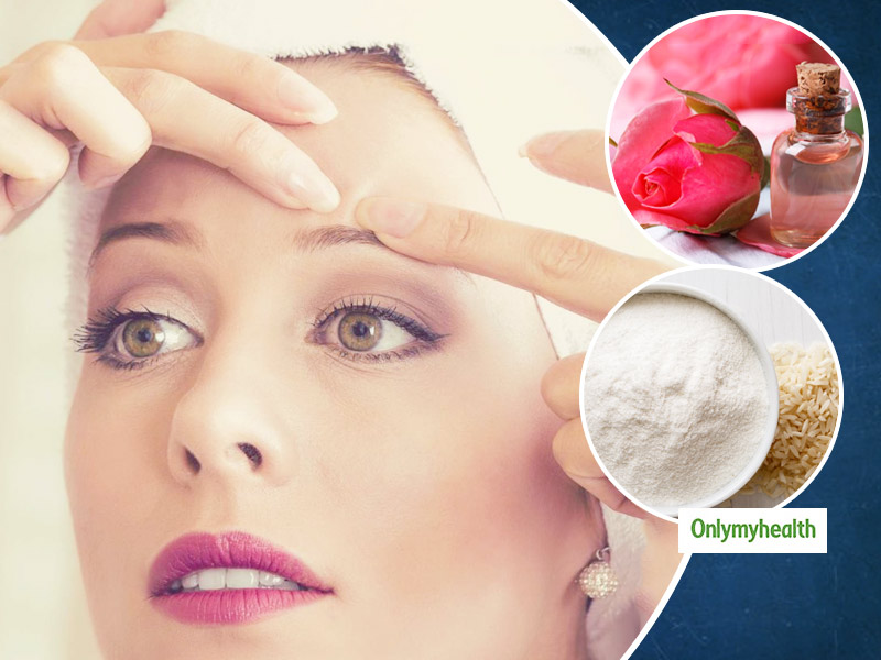 how-to-naturally-remove-whiteheads-permanently-onlymyhealth