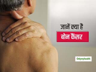 नजरअंदाज न करें हड्डियों में होने वाली गांठ और सूजन, बोन कैंसर का हो सकता है खतरा
