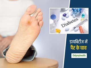डायबिटीज रोगी पैर में घाव या चोट को न करें नजरअंदाज, हो सकते हैं कई खतरे