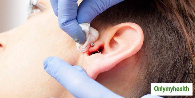 Pimple In Ear: Causes and How to Get Rid of Ear Acne