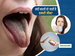 इन 5 गंदी आदतों के कारण आपके जीभ का रंग हो जाता है बदरंग, जानें काली जीभ के कारण और बचाव के उपाय