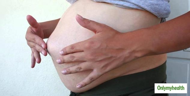 Hernia During Pregnancy