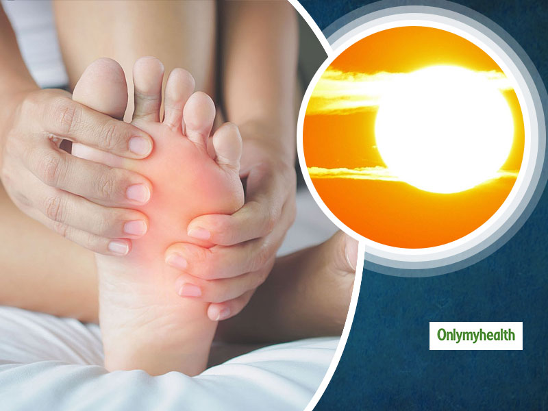 How To Prevent Yourself From Heat Edema?