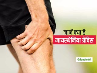 मायस्थेनिया ग्रेविस क्या है, जानिए कारण, लक्षण और उपचार 