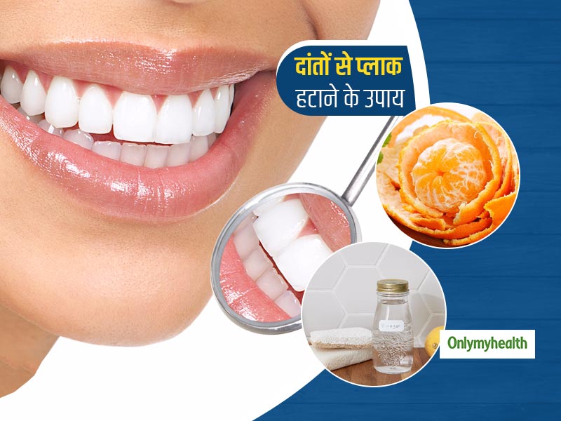 दांतों के प्लाक और टार्टर की इन 5 चीजों से करें सफाई, मुंह के स्वास्थ्य के लिए भी है फायदेमंद