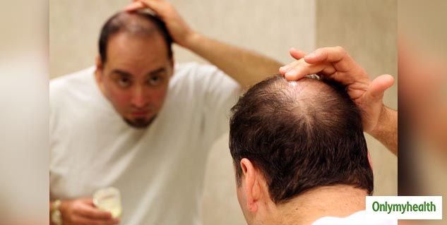 Hair Fall In Mens
