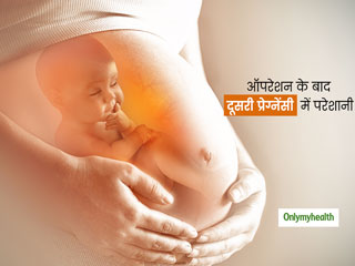 पहला बच्चा ऑपरेशन (सी-सेक्शन) से हुआ तो दूसरी बार मां बनने में आ सकती है परेशानी, वैज्ञानिक शोध में हुआ खुलासा