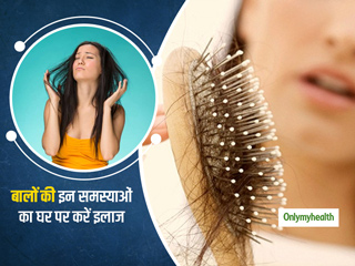 बालों की अलग-अलग समस्याओं के लिए अपनाएं ये 4 घरेलू नुस्खे, जानें इस्तेमाल करने का आसान तरीका