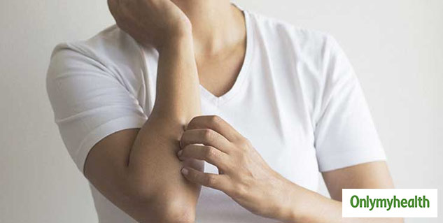 Iron Deficiency Sign On Skin
