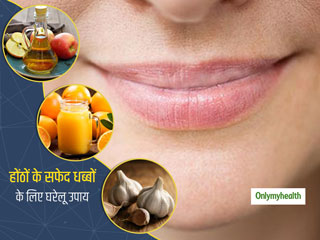 Lips White Spot: होंठो में पड़े सफेद धब्‍बों से हैं परेशान, तो इससे छुटकार दिलाएंगे ये 4 असरदार घरेलू उपाय 