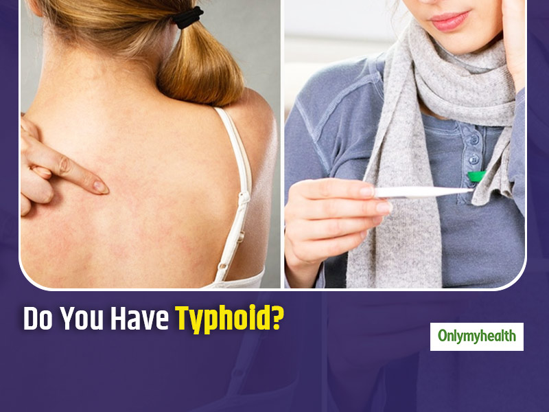 Here Are 7 Warning Signs of Typhoid That You Should Not Ignore
