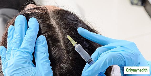 Losing Hair Life Never Before? These 4 Hair Loss Treatments Can Help ...