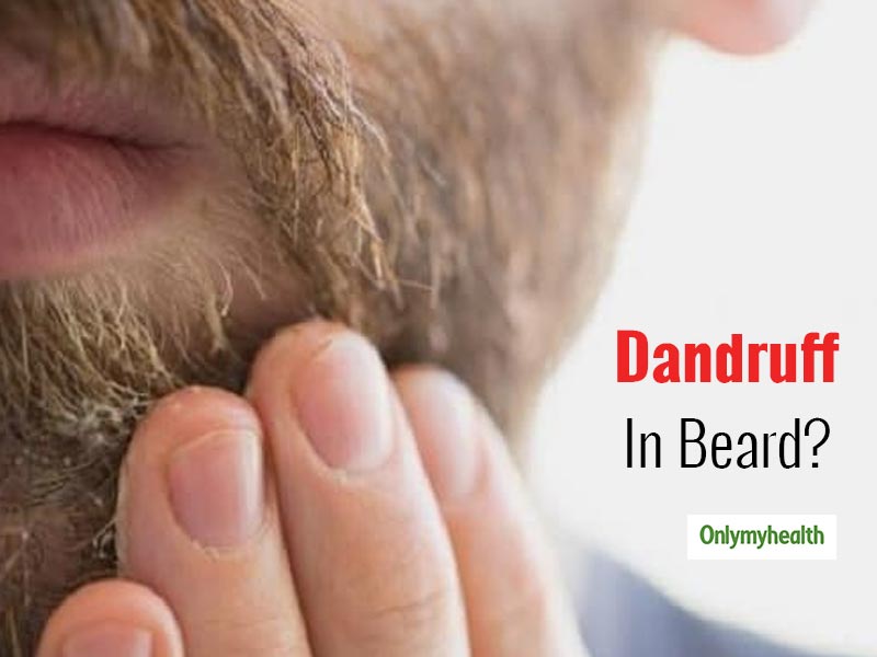 beard dandruff shampoo