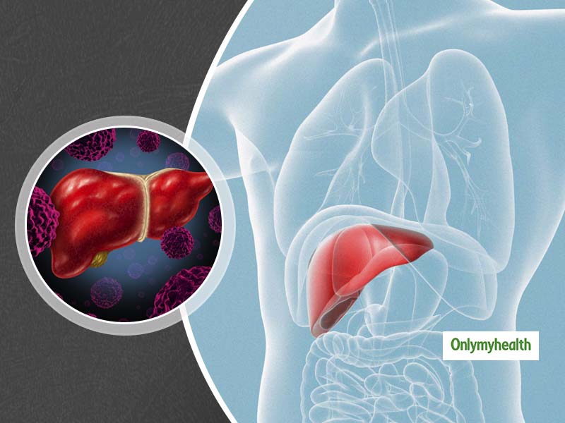 World Hepatitis Day 2020: This Viral Disease Is Silent, Difficult To ...