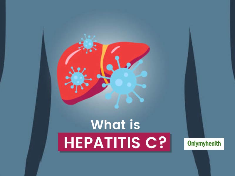 All You Need To Know About Hepatitis C | OnlyMyHealth