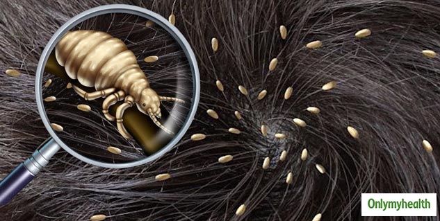 Remedies To Deal With Lice