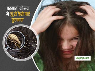Remedies To Deal With Lice: बरसाती मौसम में बढ़ सकती है सिर की जुंएं, जानें कैसे पाएं जूंओं से छुटकारा 