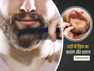 दाढ़ी में डैंड्रफ से छुटकारा पाना है तो रोज करें ये 3 काम, लंबी दाढ़ी होने पर भी नहीं होगी रूसी की समस्या