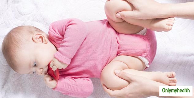 Hip Dysplasia In Babies