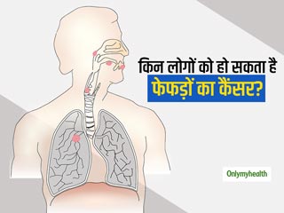 World Lung Cancer Day 2020:  इन 5 तरह के लोगों को हो सकता है फेफड़ों का कैंसर, जानिए कब कराएं फेफड़ों की जांच