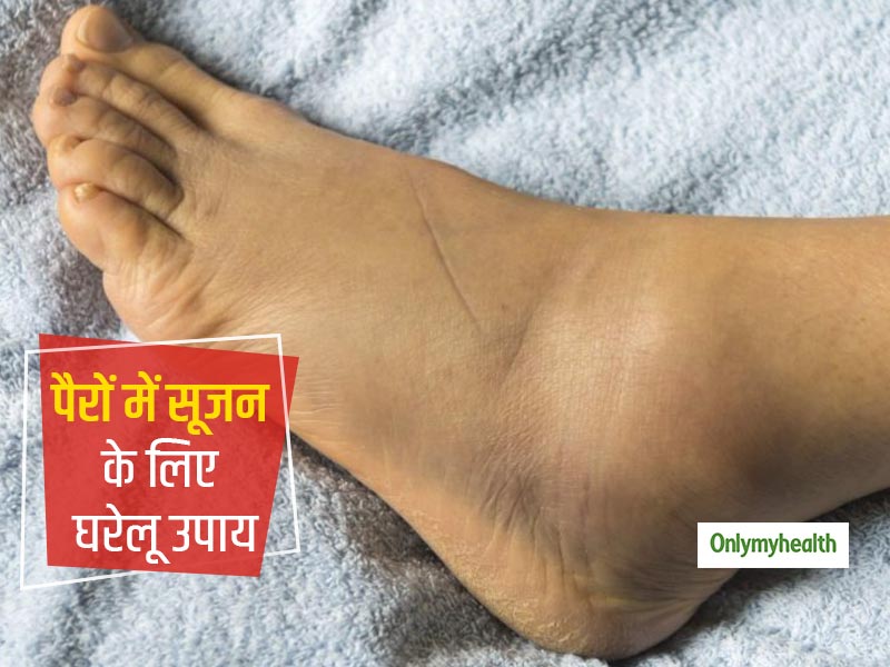 पैरों में सूजन की समस्या बनी रहती है तो इन 4 नैचुरल तरीकों से करें घर पर इलाज, जल्द मिलेगा आराम