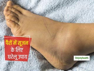 पैरों में सूजन की समस्या बनी रहती है तो इन 4 नैचुरल तरीकों से करें घर पर इलाज, जल्द मिलेगा आराम