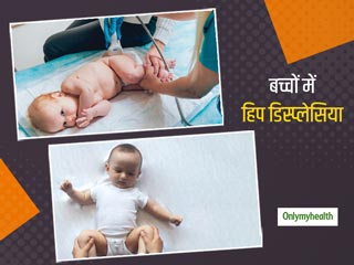 कूल्‍हों से जुड़ी समस्‍या है हिप डिस्प्लेसिया, जानें कैसे करती है बच्‍चे के चलने-फिरने को प्रभावित