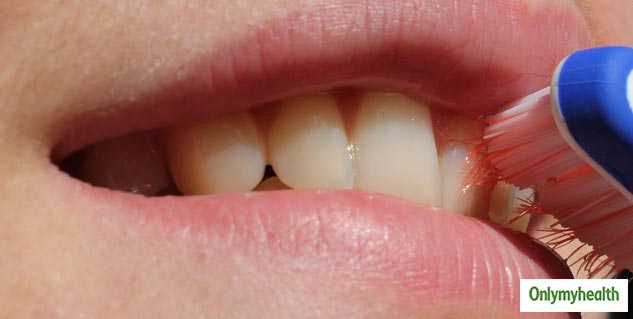 mouth problem
