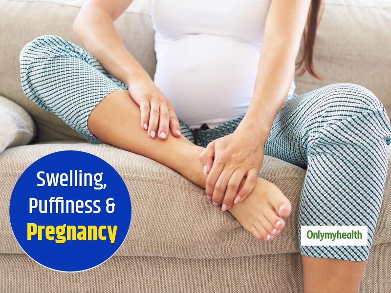 swelling-and-puffiness-during-pregnancy-are-normal-here-are-some-cure