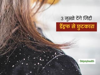 महंगे से महंगा शैम्पू करने पर भी बालों से नहीं जा रहा जिद्दी डैंड्रफ! 3 नुस्खे देंगे दर्जनभर समस्याओं से निजात